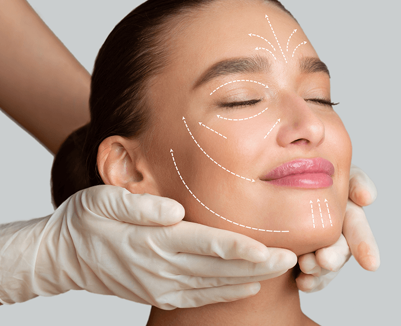 Lifting de Face