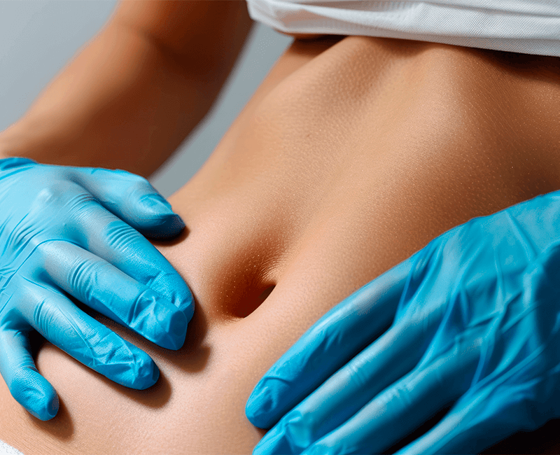 Mini Abdominoplastia