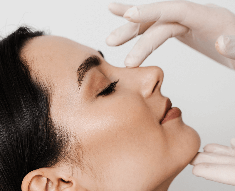 Rinoplastia